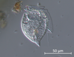Dinoflagellaten Dinophysis odiosa